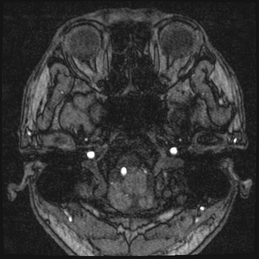 Click on the Serie image to view the images of VILLANUEVA, WILLIAM A.